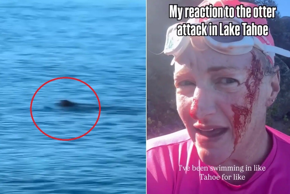 Nadadora é atacada por lontra em lago nos EUA e leva 38 pontos - QTU Questões do Universo
