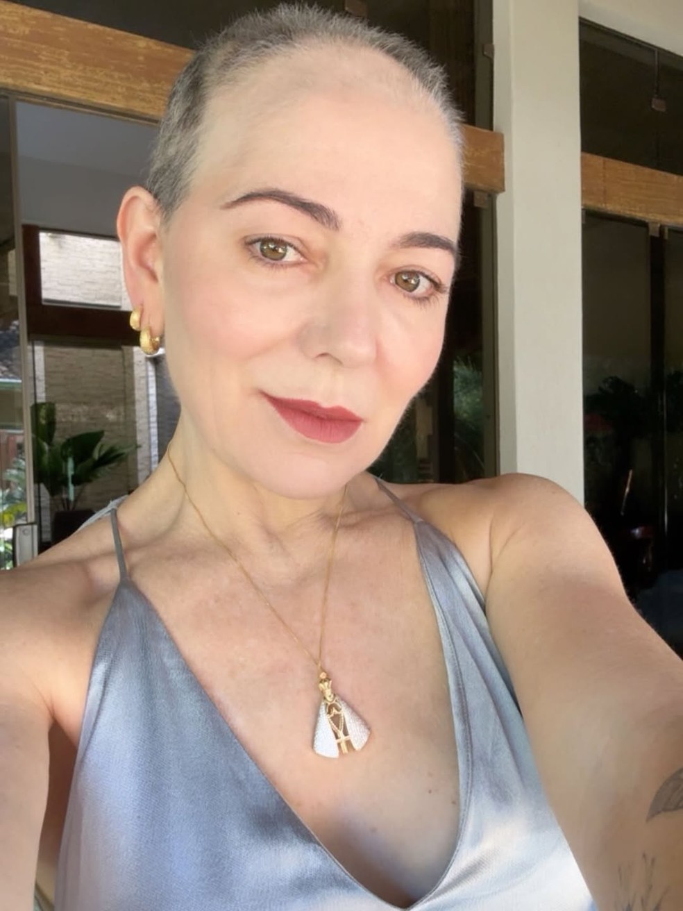 Mãe de Lucas Lucco, Karina foi diagnosticada com alopecia areata — Foto: Reprodução/Instagram