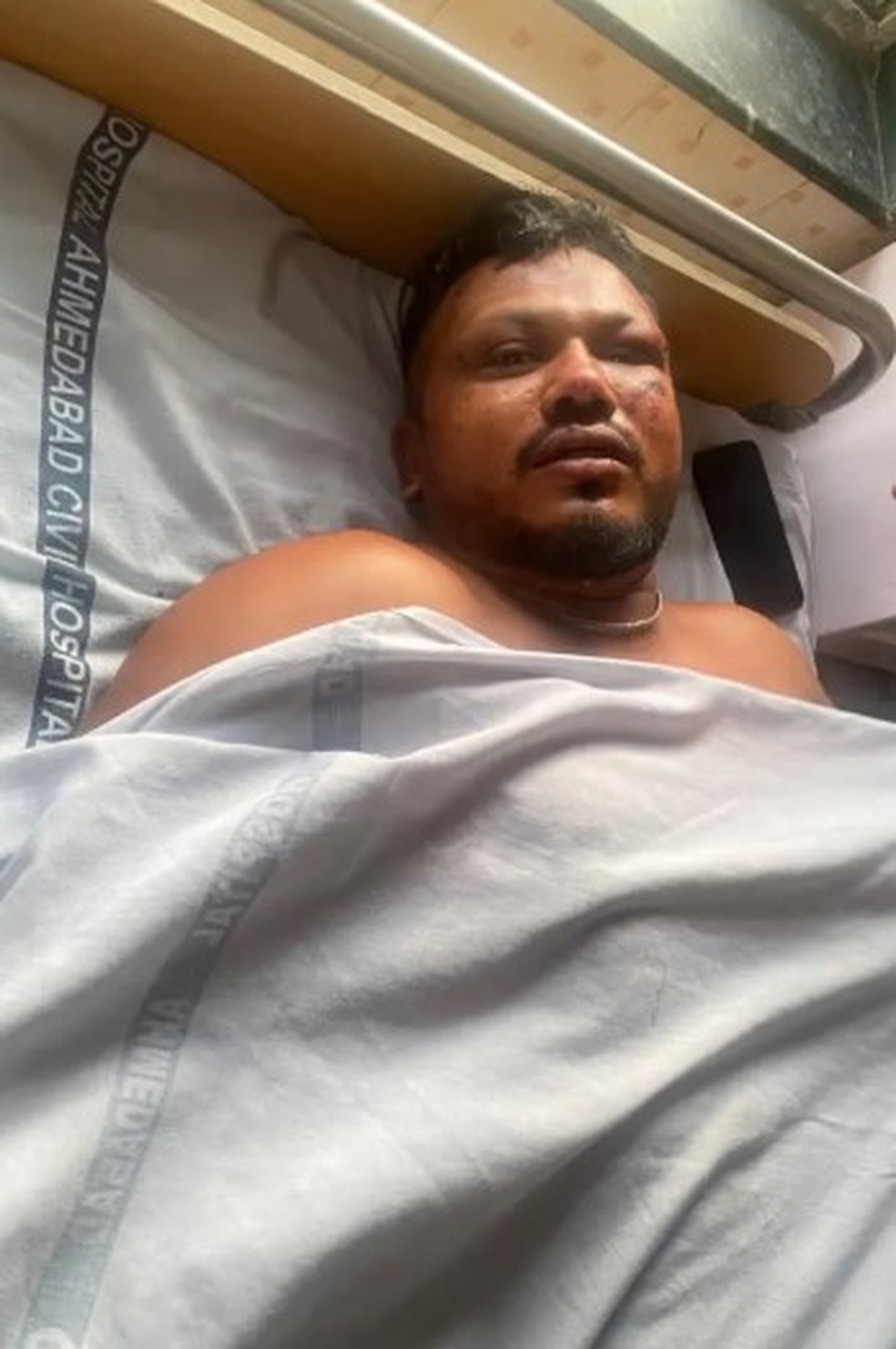 Vishwash Kumar Ramesh, de 40 anos, o único sobrevivente de acidente que matou 241 a bordo de avião da Air India — Foto: Reprodução