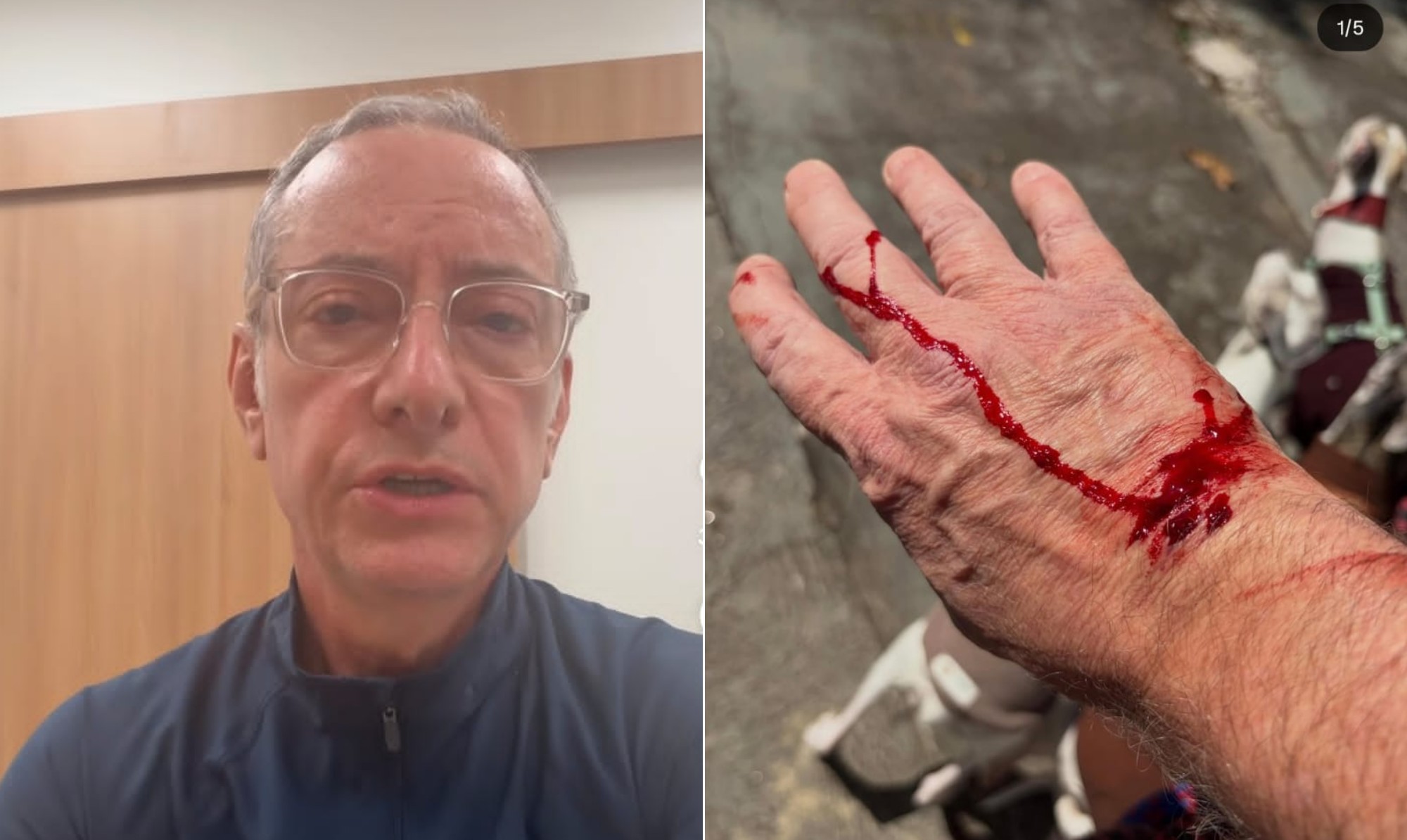 José Roberto Burnier é atacado por pitbull durante passeio em São Paulo
