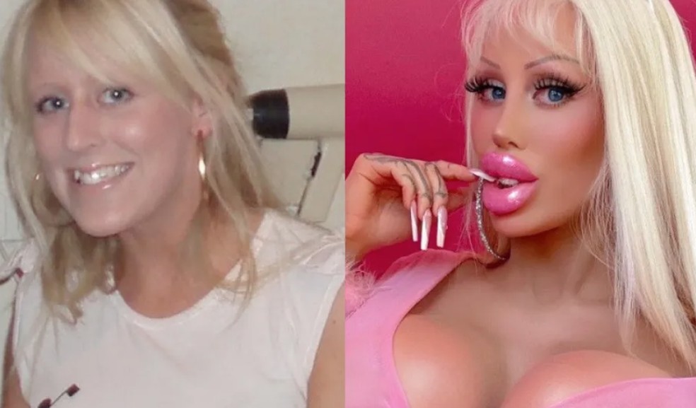 Antes e depois de Alicia Amira — Foto: Reprodução