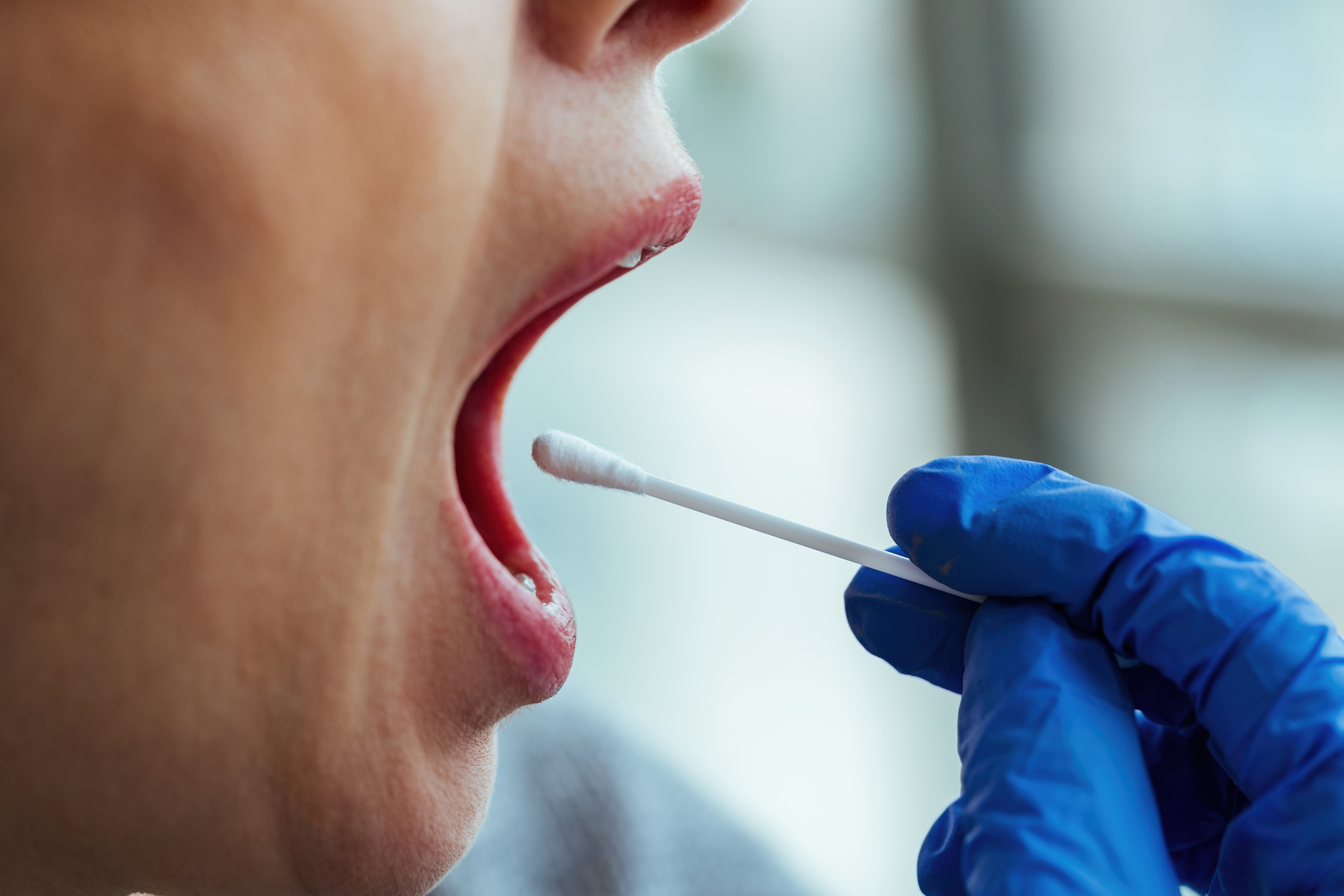 Estomatite: o que é essa inflamação que provoca feridas dolorosas na boca? - QTU Questões do Universo