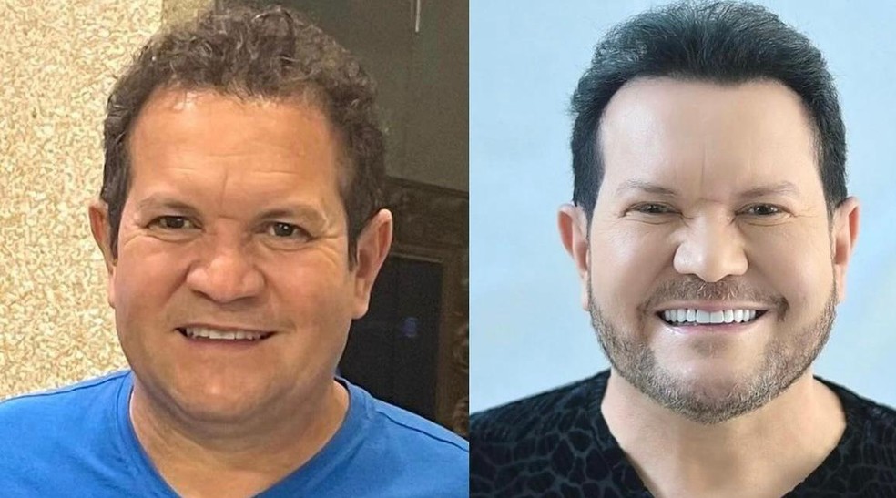 Ximbinha faz nova harmoniza&ccedil;&atilde;o facial e exibe resultado &mdash; Foto: Reprodu&ccedil;&atilde;o/Instagram