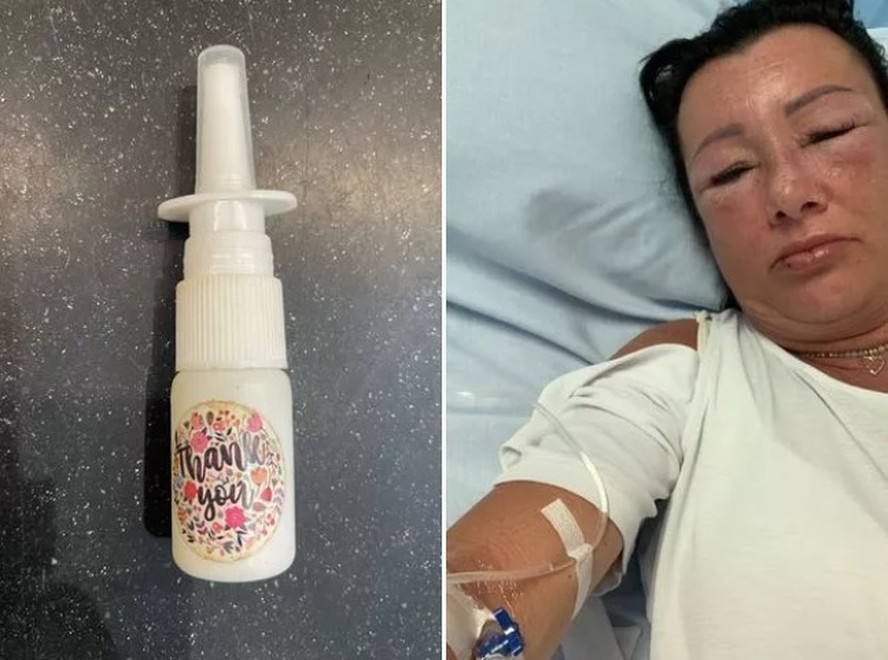 'Droga da Barbie': britânica se diz 'grata por estar viva' após sofrer ...