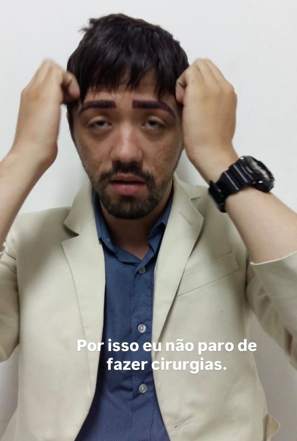 Rico Melquiades surpreende com foto antiga, antes das pl&aacute;sticas &mdash; Foto: Reprodu&ccedil;&atilde;o/Instagram