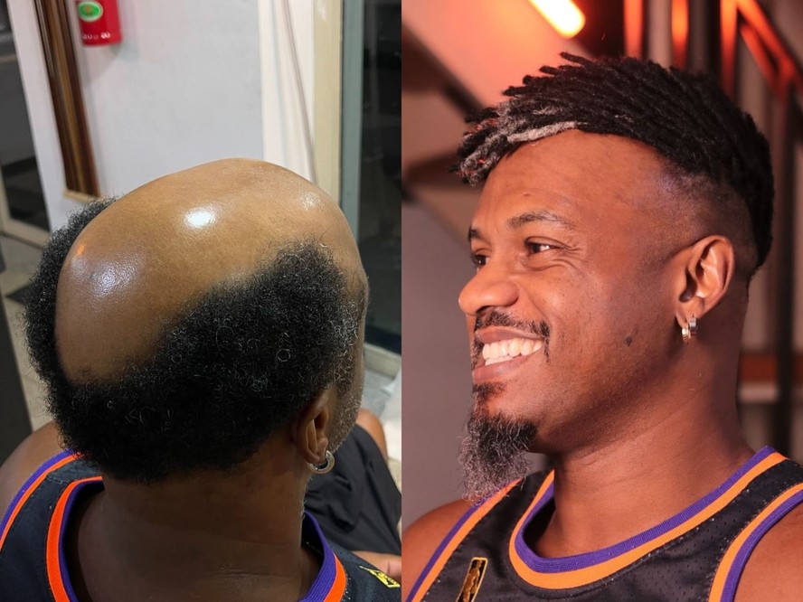 Barbearia faz turnê com técnica de dreads em calvos às cegas e emociona ...