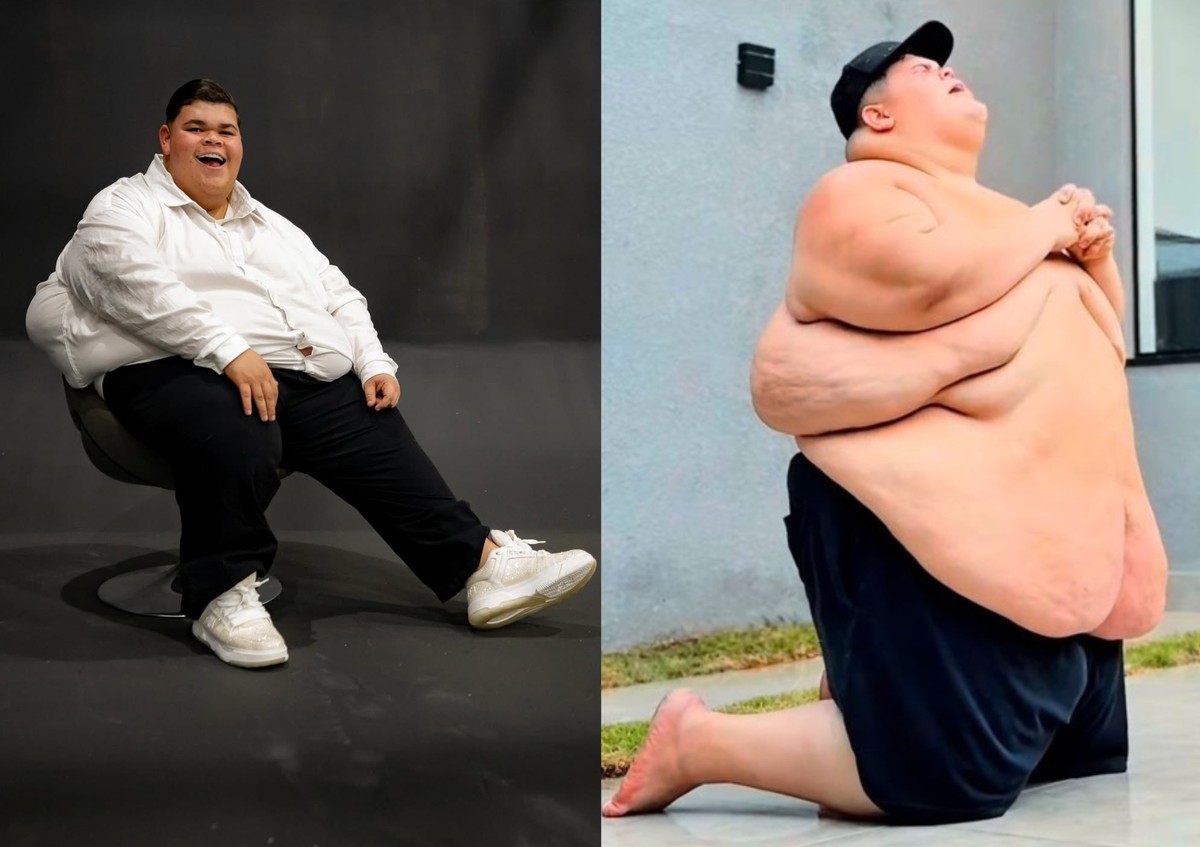 Com menos 115kg, Gordão da XJ planeja realizar cirurgia bariátrica ano ...