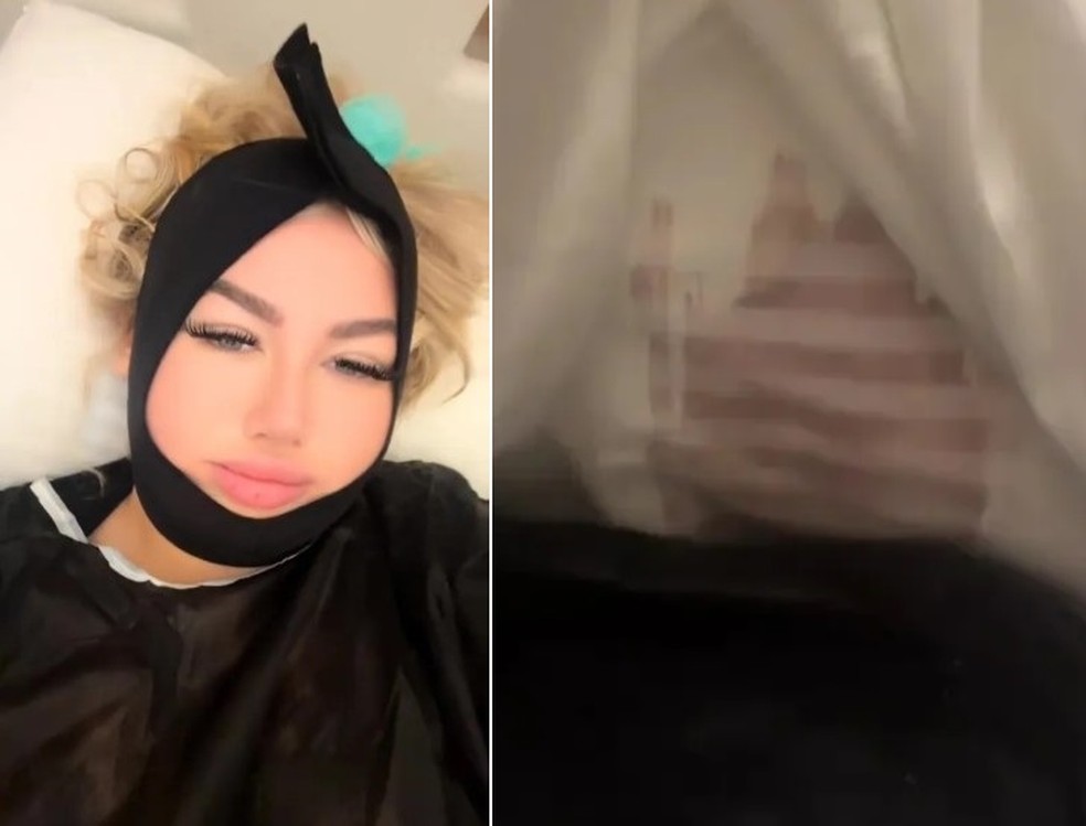 Saffron se submeteu a seis cirurgias plásticas num só dia em hospital na Turquia — Foto: Reprodução/TikTok