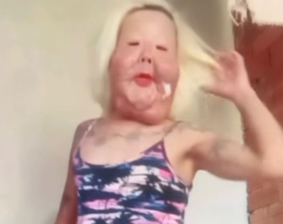 Juju do Pix mostra mudança no rosto um mês após retirar óleo mineral — Foto: Reprodução/Instagram