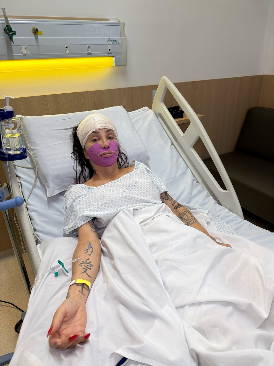 Maya Massafera detalha nova cirurgia no maxilar