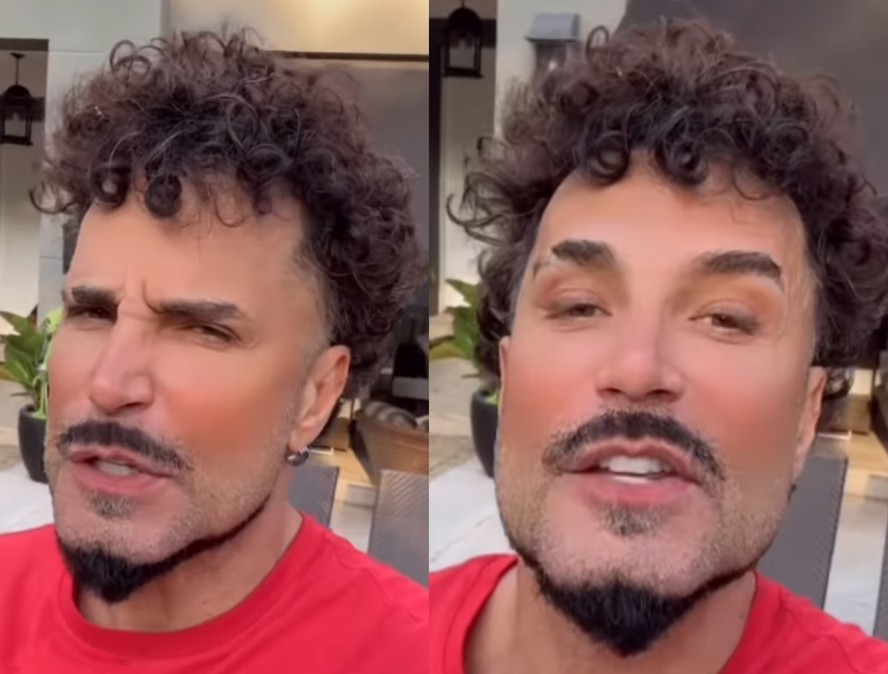 Rosto harmonizado de Latino chama atenção e viraliza nas redes sociais