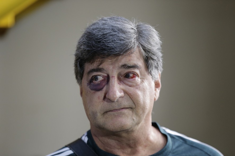 Marcelo Benchimol foi agredido durante assalto em Copacabana