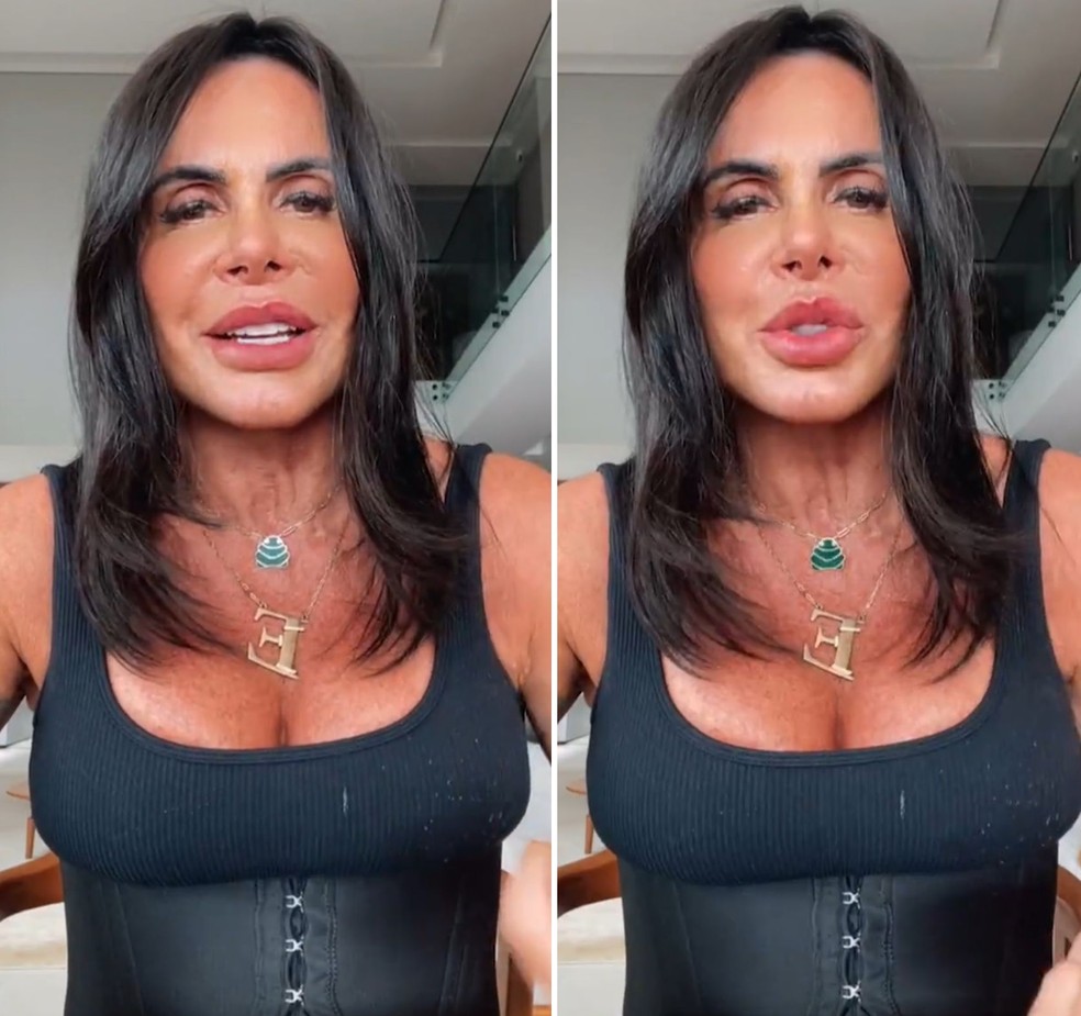 Gretchen coloca fios de silhouette no rosto: 'Mais fino e bonito' — Foto: Instagram