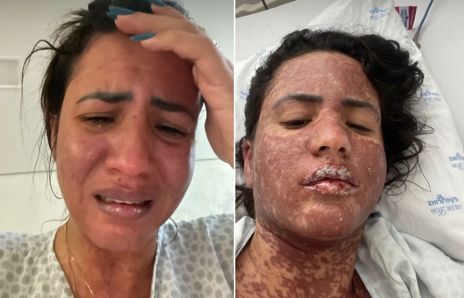 Mulher de Frank Aguiar relata internação na UTI com doença rara