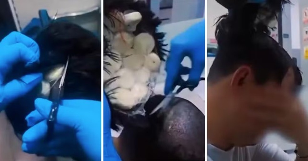 Homem tenta embarcar na Colômbia com cocaína sob peruca — Foto: Reprodução/Facebook