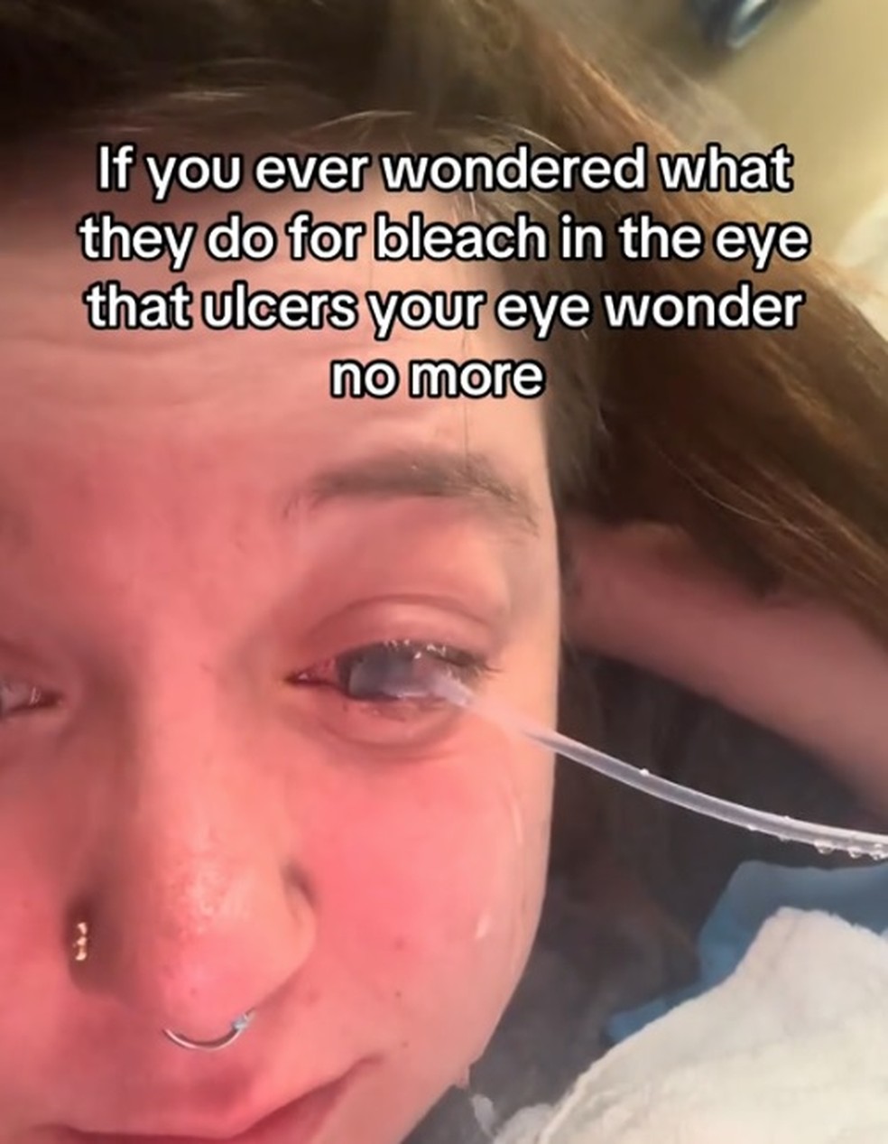 Dejah Maynard passa por procedimento de emergência em olho após acidente doméstico — Foto: Reprodução/TikTok
