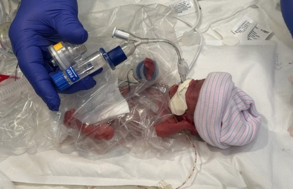 Cooper em Unidade de Terapia Intensiva Neonatal de hospital em Orlando — Foto: Reprodução/TikTok