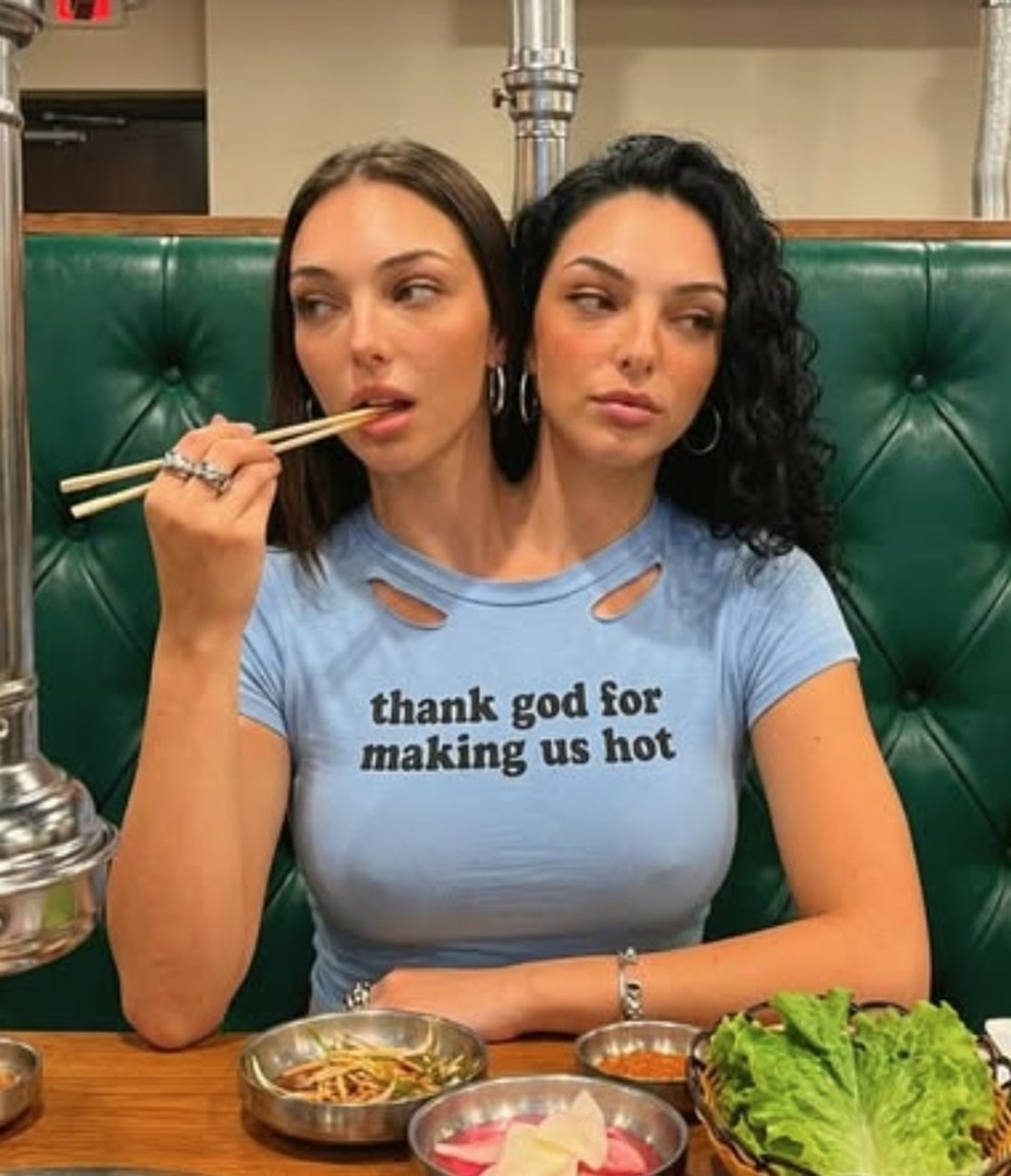 'Gêmeas siamesas' Camila e Valeria: IA — Foto: Reprodução/Instagram