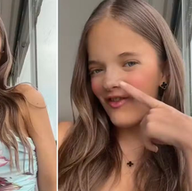 Rafa Justus após rinoplastia — Foto: Instagram