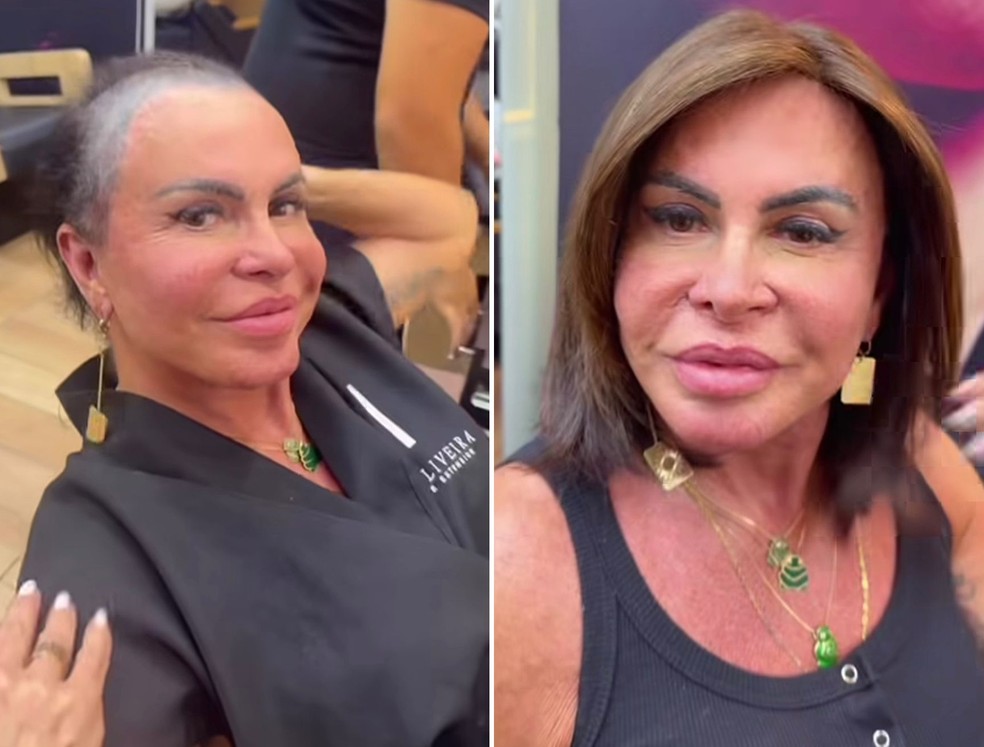Gretchen sem e com a prótese capilar — Foto: Reprodução/Instagram
