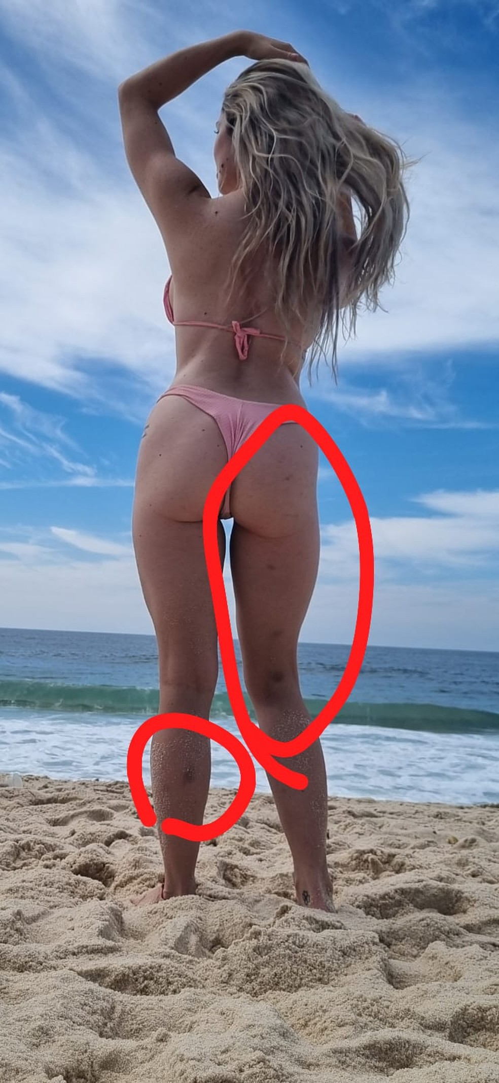 Advogada Larissa Ferrari mostrou hematomas pelo corpo ao acusar Dimitri Payet, do Vasco, de agressão — Foto: Arquivo pessoal