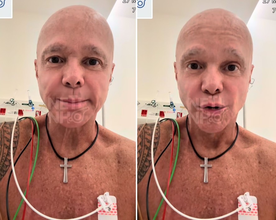 Cantor Netinho finaliza quarta etapa de quimioterapia: 'Tomei 128 injeções na barriga'