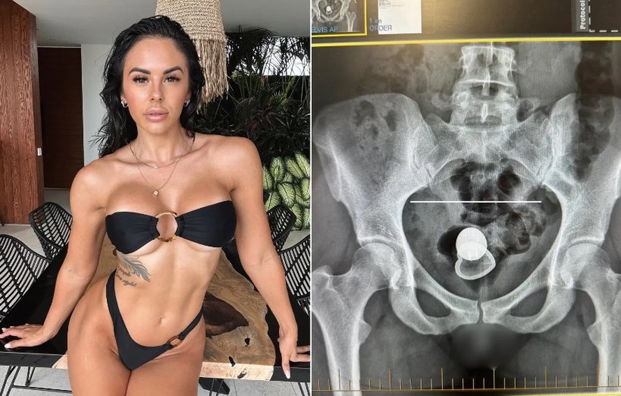 plug anal na mulher Plug anal inflável MRIMIN com agulha destacável e brinquedos sexuais a main image 1