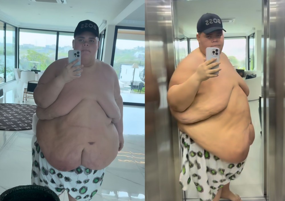 contioutra.com - De 349kg para 250kg: Após perder peso drasticamente, Gordão da XJ passa mal e revela detalhes do susto no hospital