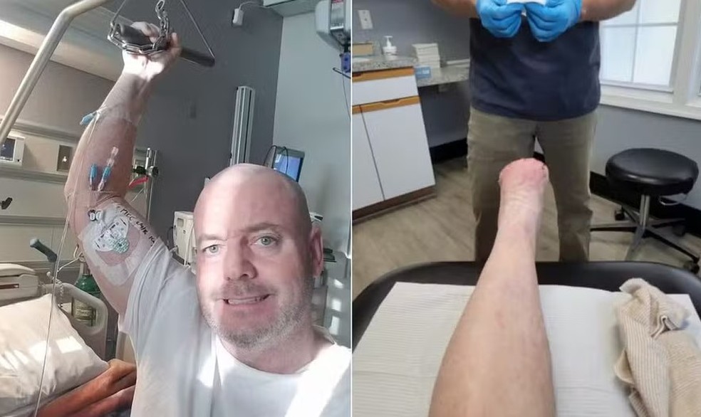 Após ter o pênis decepado pela esposa, John Wayne Bobbitt perde os dedos dos pés devido a uma doença rara — Foto: Reprodução/Facebook