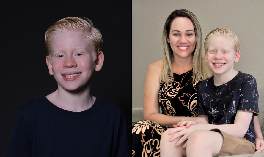 Mãe de Felipe Melquiades, o Cristian de 'Terra e paixão', conta como família se adaptou ao albinismo do ator