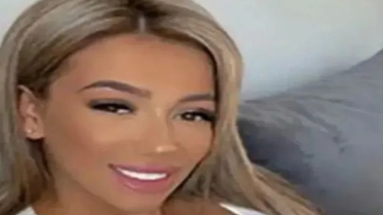 Médica que fez necrópsia critica lifiting de bumbum brasileiro após a morte de  paciente britânica 