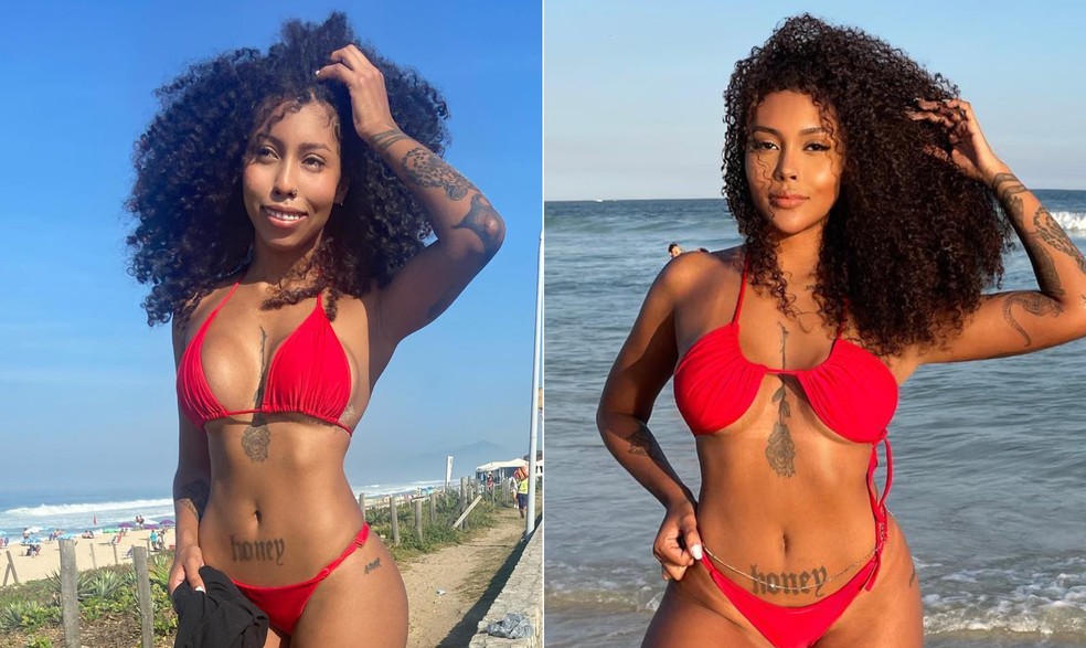 Giovanna Jacobina fez cirurgia ortognática — Foto: Reprodução/Instagram