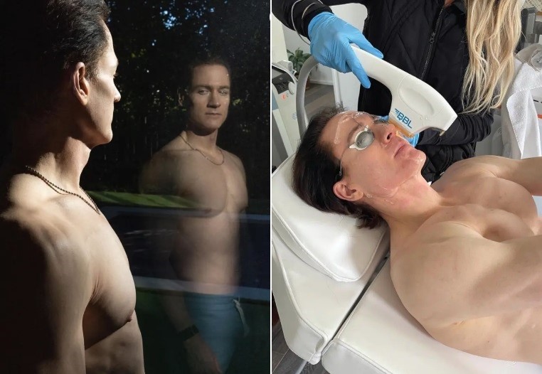 Biohacker que tenta voltar aos 18 anos desabafa: 