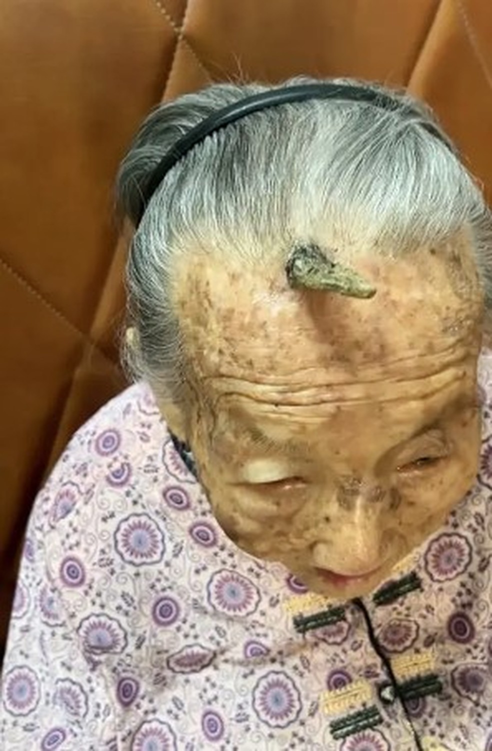 Chifre cresce há vários anos na testa de Chen — Foto: Reprodução