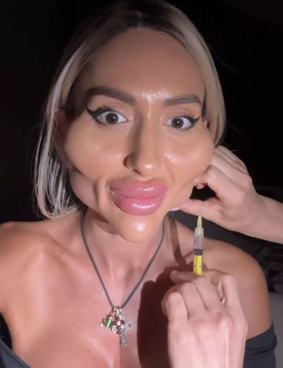 Anastasiia Pokreshchuk se submete a preenchimento na mand&iacute;bula &mdash; Foto: Reprodu&ccedil;&atilde;o/Instagram