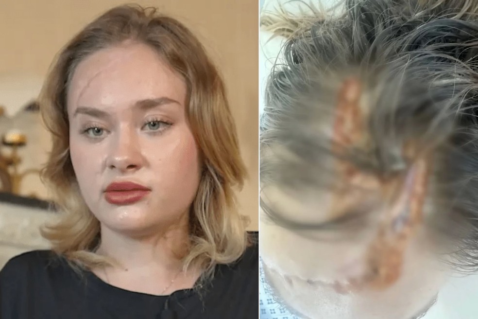 Modelo ucraniana Maria Kovalchuk foi escalpelada em Dubai — Foto: Reprodução
