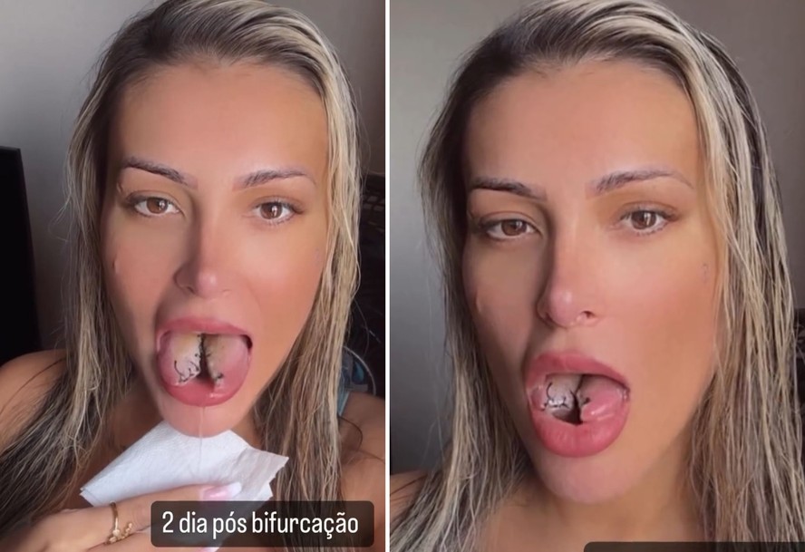 Lingua Cortada Ao Meio