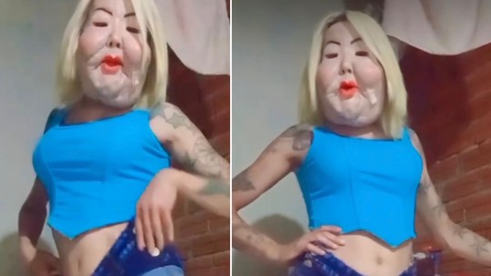 Juju do Pix mostra recuperação após cirurgia para remover óleo mineral e manda recado: 'Um corpo é um corpo'