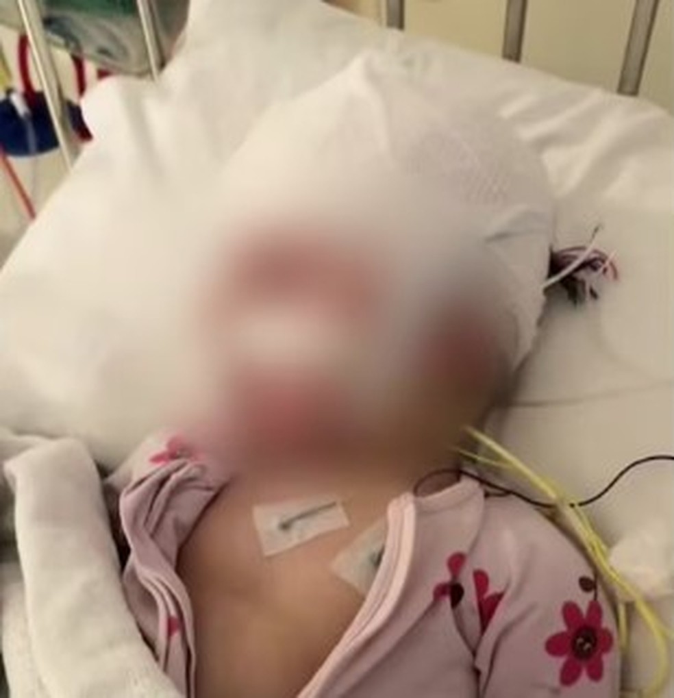 Bebê após abuso de medicamentos feito pela mãe na Austrália — Foto: Reprodução