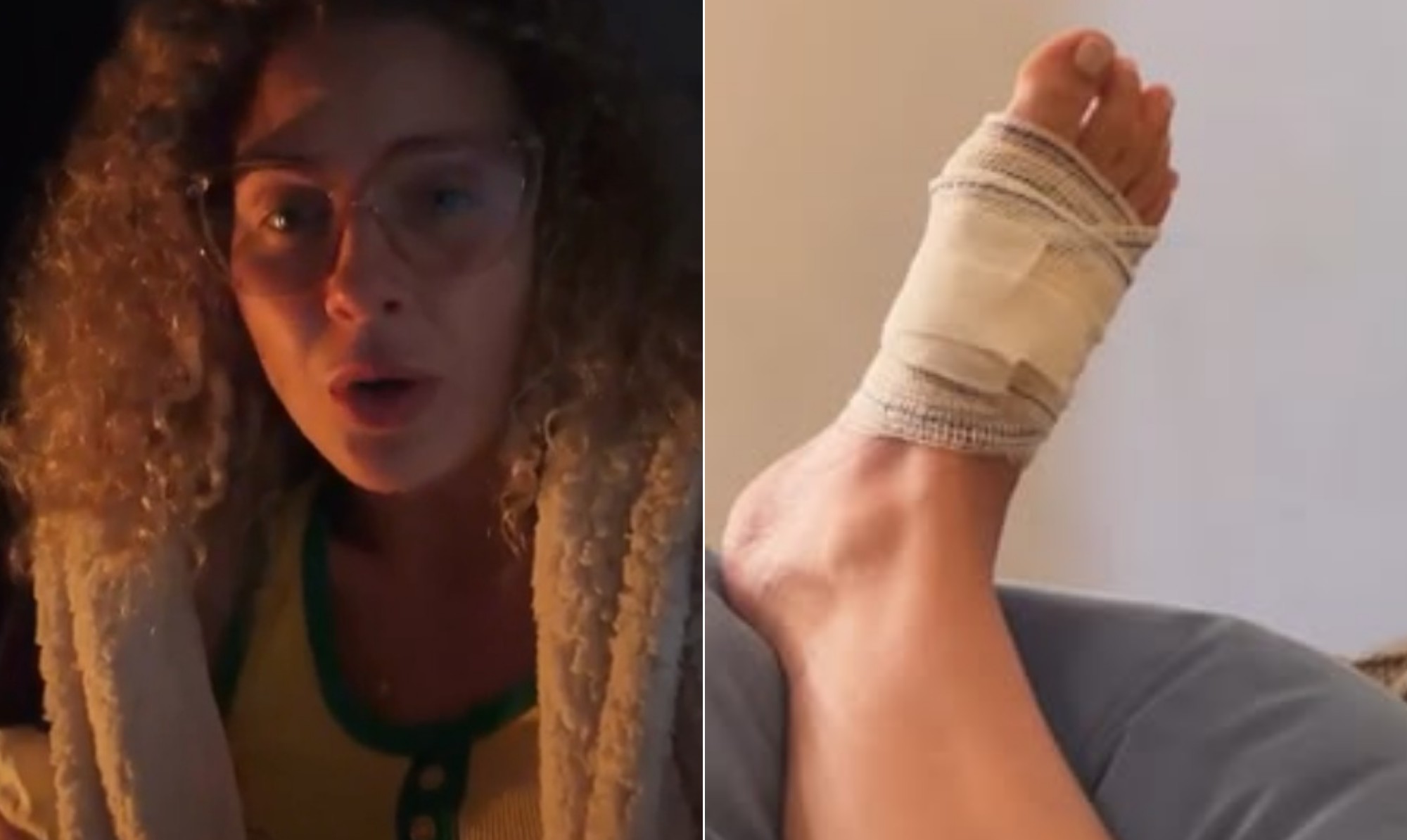 Debby Lagranha passa por cirurgia após ser picada por uma aranha: 'Chorei de dor'