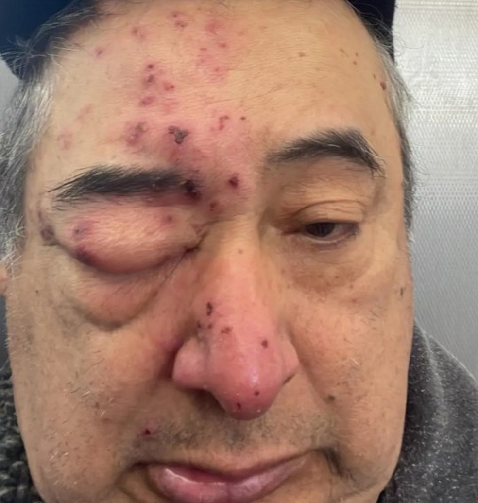 Heriverto Hernandez acordou no meio da noite em Chicago com ratos roendo o seu rosto &mdash; Foto: Reprodu&ccedil;&atilde;o