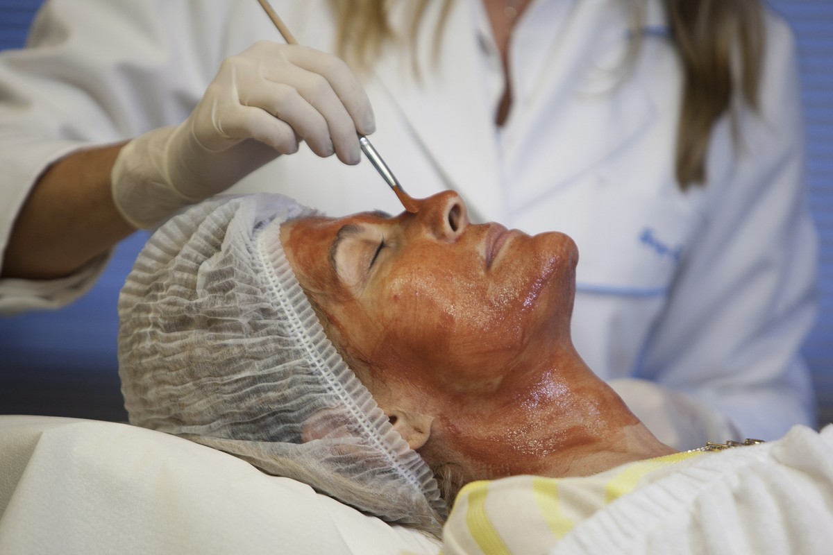 Mulher é indenizada em R 8 mil por queimadura no rosto após