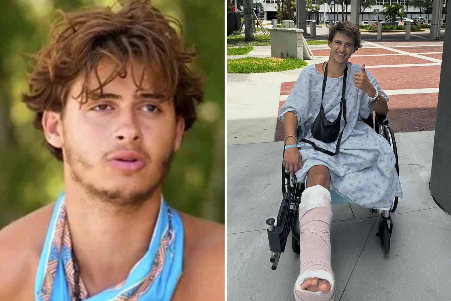 Ex-participante de reality show pede indenização de R$ 510 milhões após acidente que levou à amputação de perna - QTU Questões do Universo