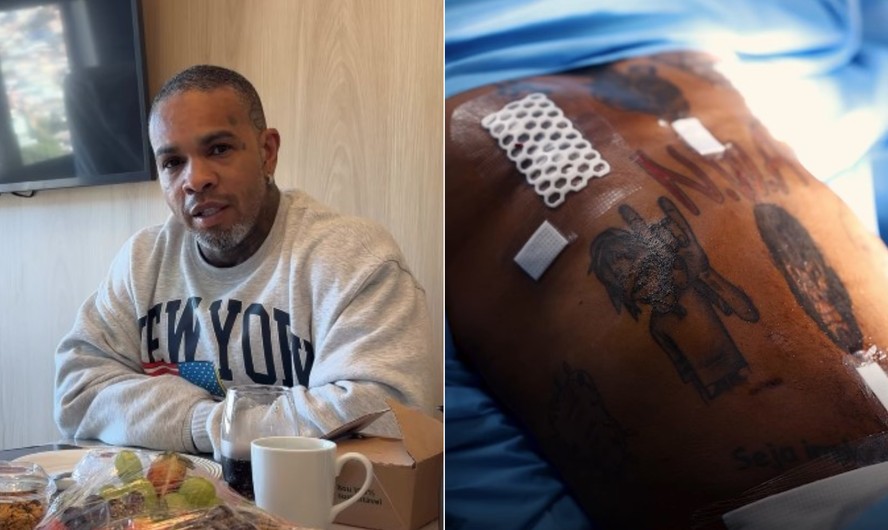 Rodriguinho passa por cirurgia reparadora e mostra recuperação: 'Morro de medo'