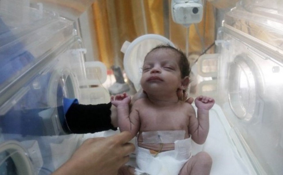 Beb&ecirc; nasceu na Faixa de Gaza ap&oacute;s cesariana em morta em bombardeio israelense &mdash; Foto: AFP
