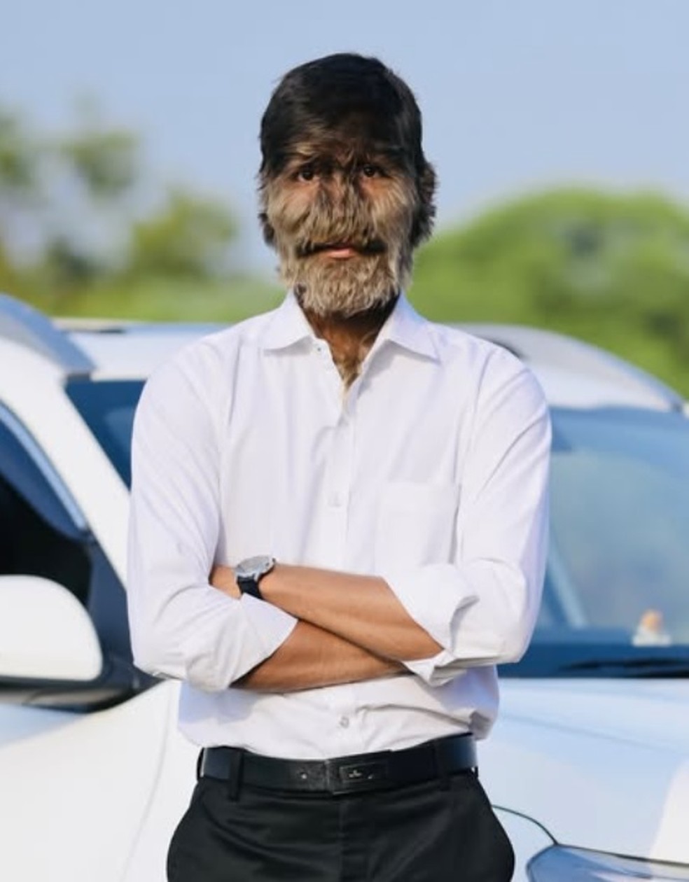 Influencer indiano Lalit Patidar, de 19 anos, tem o rosto mais peludo do mundo — Foto: Reprodução/Instagram