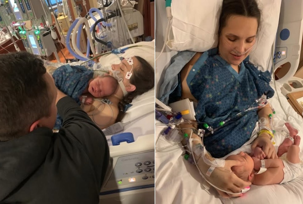 Archer sobre o peito de Casey ainda inconsciente (à esquerda) e depois de ela sair do coma — Foto: Reprodução/Instagram