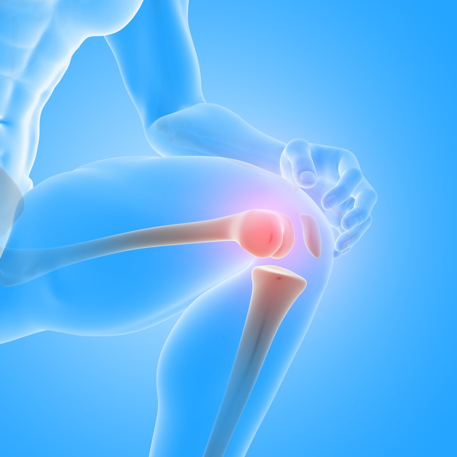 A artrose pode afetar as articulações de várias partes do corpo. Mas tem tratamento