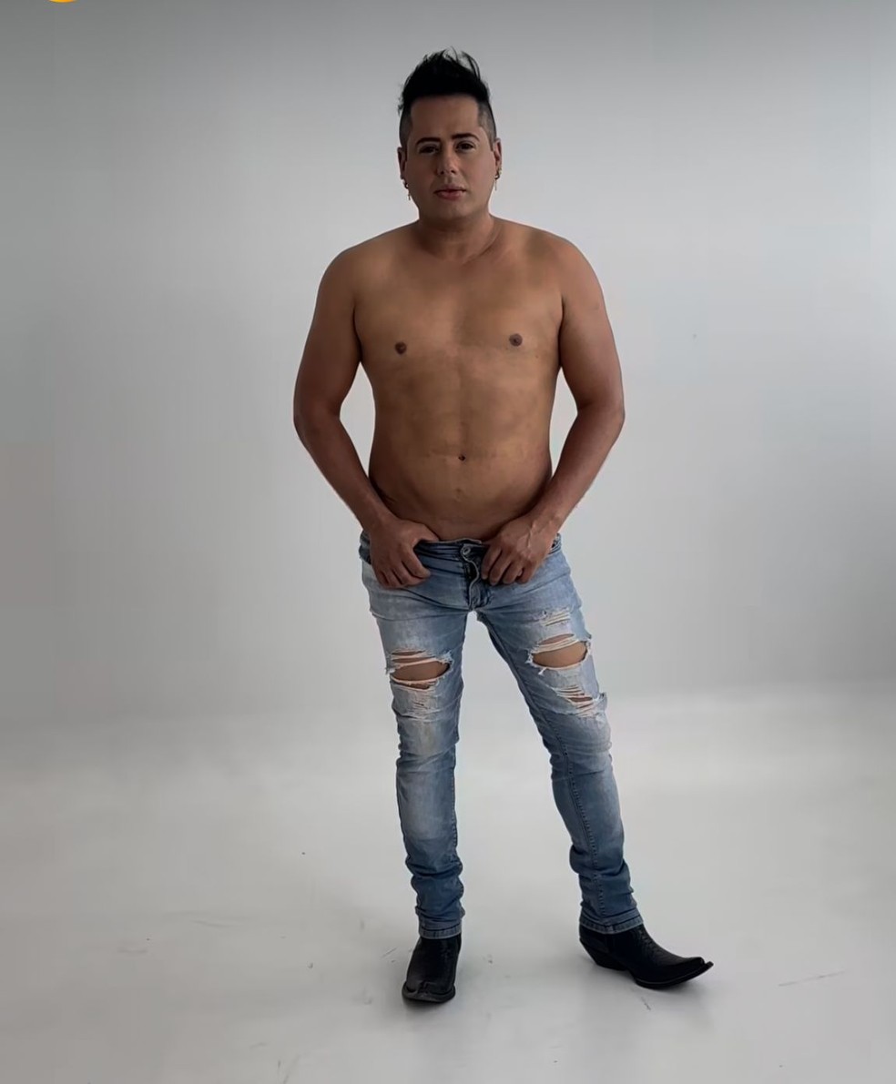 Sertanejo Hugo, da dupla com Tiago, exibe 'barriga chapada' após lipo — Foto: Instagram