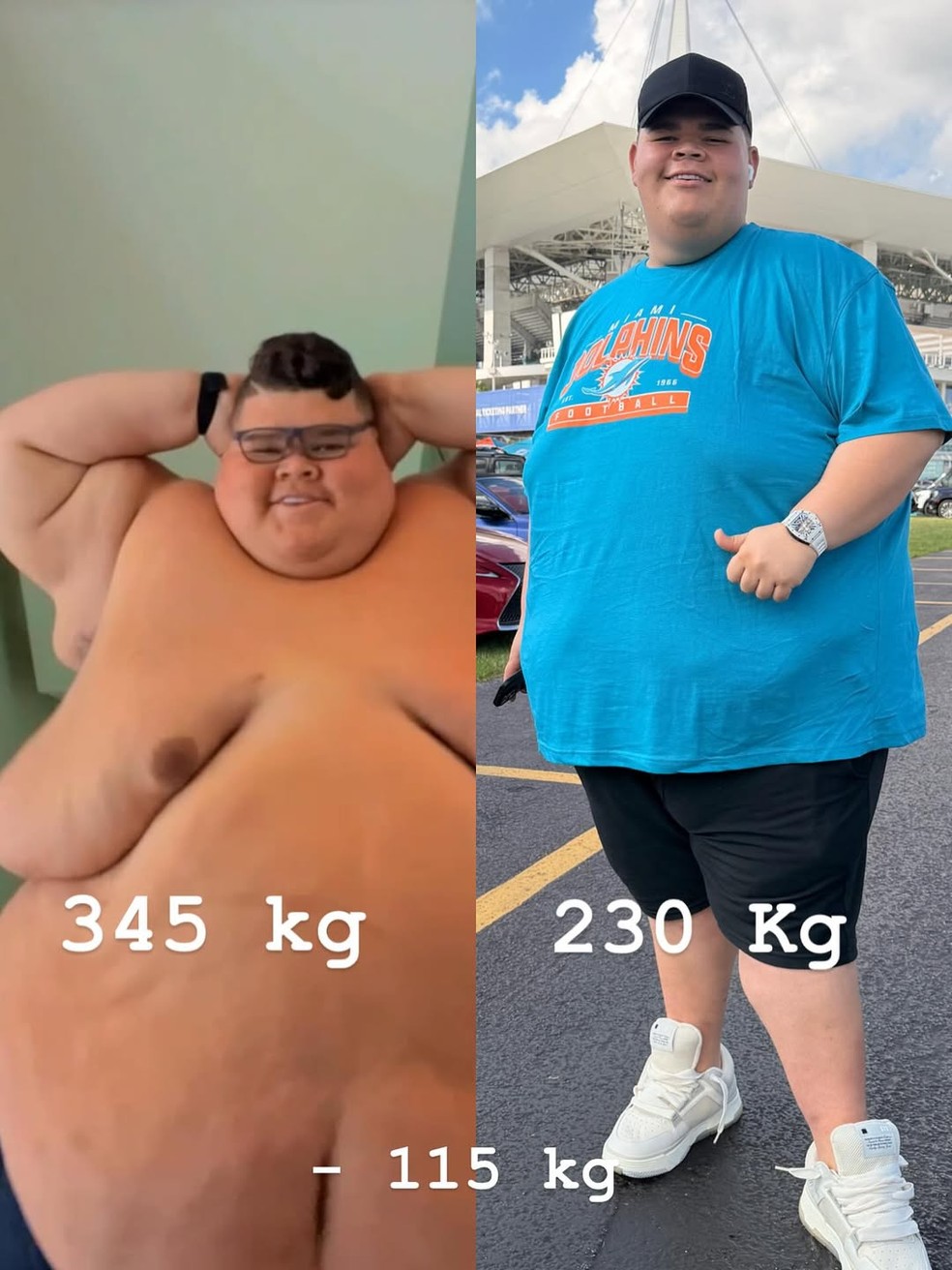 Quantos Quilos Tem O Gordão Da Xj